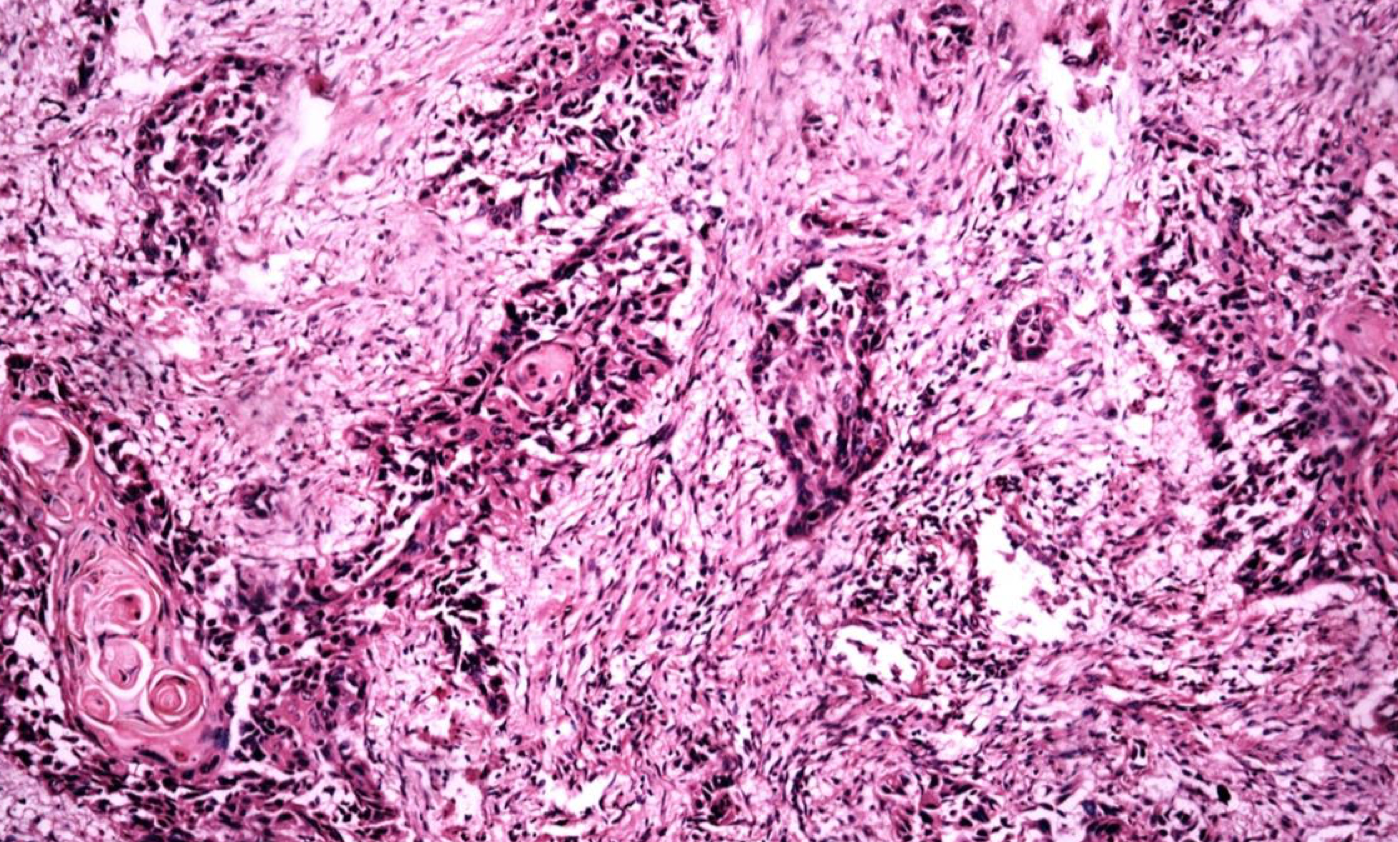 tissue imagehttps://news.rice.edu/news/2026/rice360-project-aims-bring-faster-breast-cancer-diagnosis-rural-texas