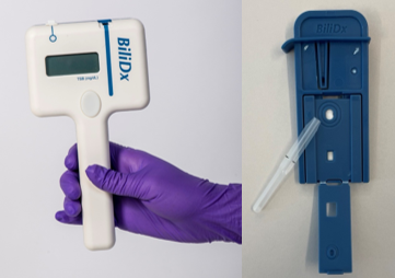 Photo: Rice360 designed BiliDx (left) measures bilirubin levels from blood using a novel test cartridge (right).